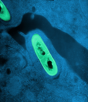 cancer en el estomago helicobacter pilory