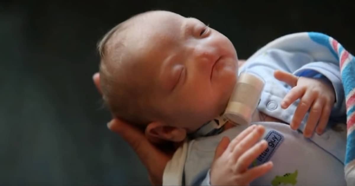 Ребенок родился в 2018 году. Патологии новорожденных. Новорожденные с патологиями. Новорождённые дети с дефектом. Дети с врожденными уродствами.