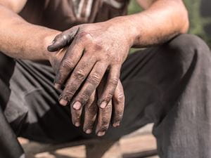 man with dirty hands