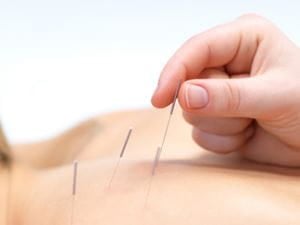 Acupuncture 101